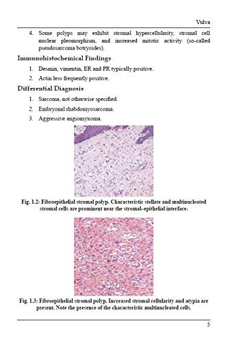 Handbook of Gynaecpathology – A Simplified Approach in Nutshell by Dr. Anandraj Vaithy. K[Paperback]