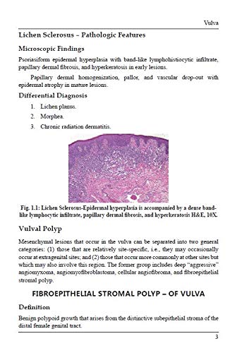 Handbook of Gynaecpathology – A Simplified Approach in Nutshell by Dr. Anandraj Vaithy. K[Paperback]