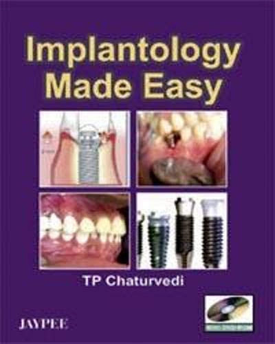 Implantology Made Easy by T.P. Chaturvedi[Paperback]